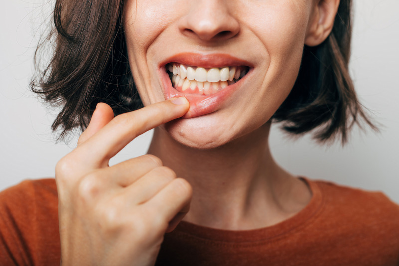 Patient showing clean gums after gum disease treatment